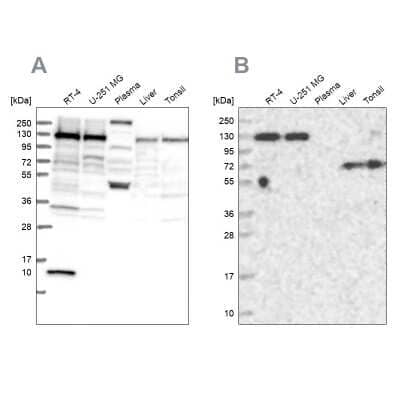 Western Blot: PPP4R1 Antibody [NBP1-87241] - Analysis using Anti-PPP4R1 antibody NBP1-87241 (A) shows similar pattern to independent antibody NBP1-87242 (B).