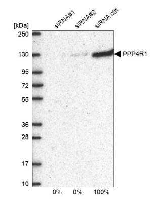 Western Blot PPP4R1 Antibody