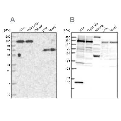 Western Blot PPP4R1 Antibody