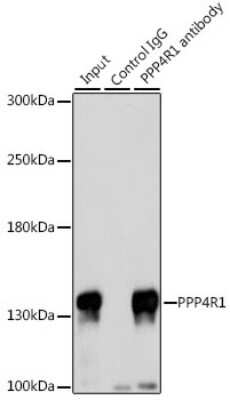 Western Blot: PPP4R1 Antibody [NBP2-94582] - Analysis of 200ug extracts of 293T cells, using PPP4R1 at a dilition of 1:1000.