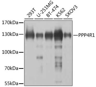 Western Blot: PPP4R1 Antibody [NBP2-94582] - Analysis of extracts of various cell lines, using PPP4R1 at 1:1000 dilution. Secondary antibody: HRP Goat Anti-Rabbit IgG (H+L) at 1:10000 dilution. Lysates/proteins: 25ug per lane. Blocking buffer: 3% nonfat dry milk in TBST. Detection: ECL Basic Kit . Exposure time: 5s.