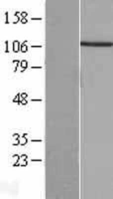 Western Blot: PPP4R1 Overexpression Lysate (Adult Normal) [NBL1-14710] Left-Empty vector transfected control cell lysate (HEK293 cell lysate); Right -Over-expression Lysate for PPP4R1.