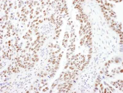 Immunohistochemistry-Paraffin PPP4R2 Antibody