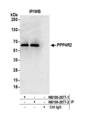 Immunoprecipitation PPP4R2 Antibody