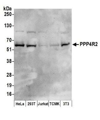 Western Blot PPP4R2 Antibody