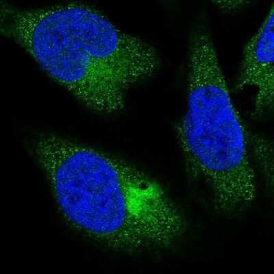 Immunocytochemistry/ Immunofluorescence PPP4R4 Antibody