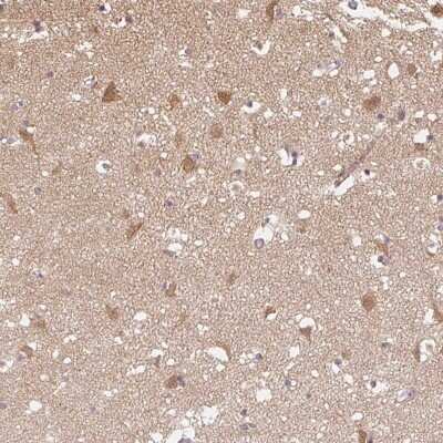 Immunohistochemistry-Paraffin: PPP4R4 Antibody [NBP2-48957] - Staining of human caudate shows moderate cytoplasmic positivity in neuronal cells.