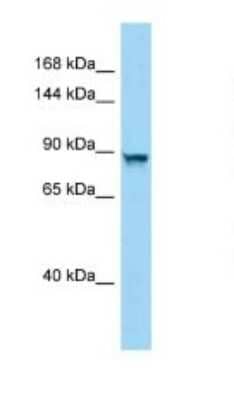 Western Blot: PPP4R4 Antibody [NBP1-98567] - Titration: 1.0 ug/ml Positive Control: Mouse Liver.