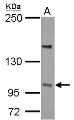 Western Blot: PPP4R4 Antibody [NBP2-19917] - Sample (30 ug of whole cell lysate) A: U87-MG 5% SDS PAGE gel, diluted at 1:1000.