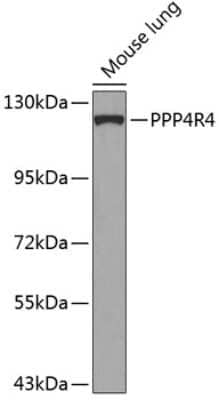 Western Blot: PPP4R4 Antibody [NBP2-94724] - Analysis of extracts of mouse lung, using PPP4R4 at 1:1000 dilution.Secondary antibody: HRP Goat Anti-Rabbit IgG (H+L) at 1:10000 dilution.Lysates/proteins: 25ug per lane.Blocking buffer: 3% nonfat dry milk in TBST.Detection: ECL Basic Kit .Exposure time: 30s.