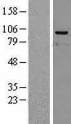 Western Blot: PPP4R4 Overexpression Lysate (Adult Normal) [NBL1-12274] Left-Empty vector transfected control cell lysate (HEK293 cell lysate); Right -Over-expression Lysate for PPP4R4.