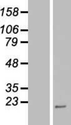 Western Blot: PPP4R4 Overexpression Lysate (Adult Normal) [NBP2-06584] Left-Empty vector transfected control cell lysate (HEK293 cell lysate); Right -Over-expression Lysate for PPP4R4.