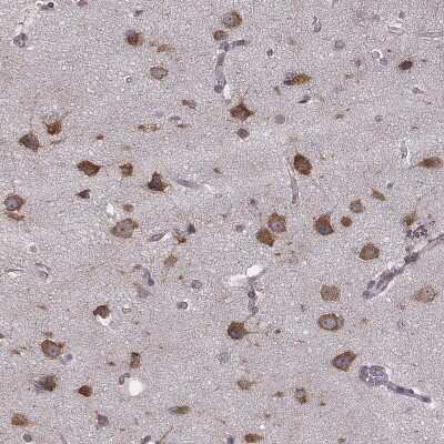 Immunohistochemistry: PPP5D1 Antibody [NBP2-68950] - Immunohistochemical staining of human cerebral cortex shows strong cytoplasmic positivity in neuronal cells.