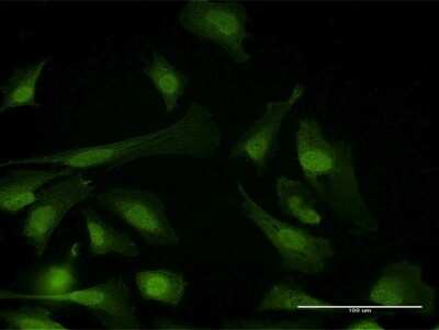 Immunocytochemistry/Immunofluorescence: PPP6C Antibody [H00005537-B01P] - Analysis of purified antibody to PPP6C on HeLa cell. (antibody concentration 10 ug/ml)