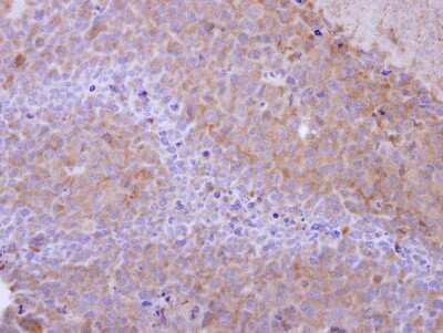 Immunohistochemistry-Paraffin: PPP6C Antibody [NBP2-19918] - PC14 xenograft, using PPP6C antibody at 1:500 dilution. Antigen Retrieval: Citrate buffer, pH 6.0, 15 min. 