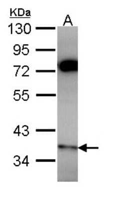 Western Blot: PPP6C Antibody [NBP2-19918] - Sample (30 ug of whole cell lysate) A: Hela 10% SDS PAGE gel, diluted at 1:1000.