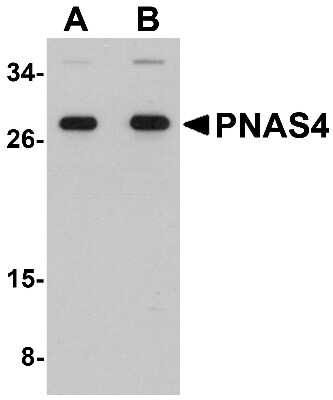 Western Blot: PPPDE1 Antibody [NBP1-76320] - EL4 cell lysate with PPPDE1 antibody at (A) 1 and (B) 2 ug/ml.