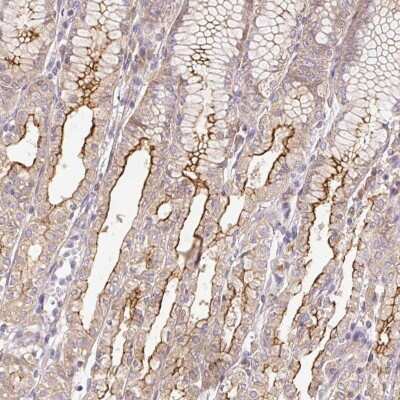 Immunohistochemistry PPPDE2 Antibody - BSA Free