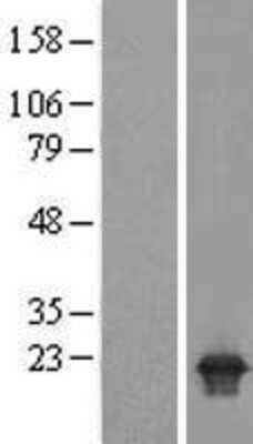 Western Blot: PPPDE2 Overexpression Lysate (Adult Normal) [NBL1-10484] Left-Empty vector transfected control cell lysate (HEK293 cell lysate); Right -Over-expression Lysate for PPPDE2.