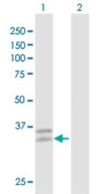 Western Blot PPT2 Antibody