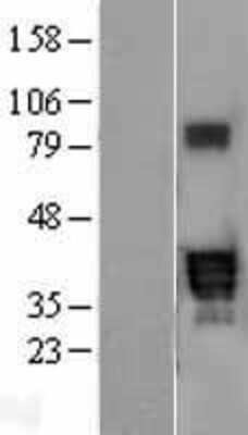 Western Blot PPT2 Overexpression Lysate