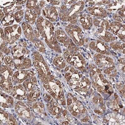 Immunohistochemistry-Paraffin PPTC7 Antibody - BSA Free