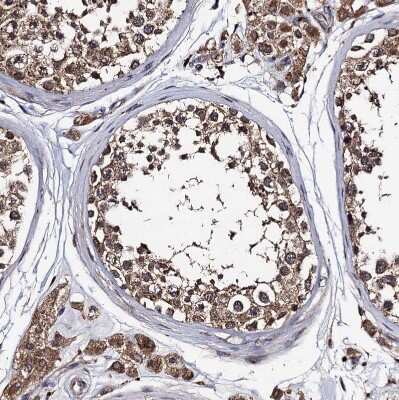 Immunohistochemistry-Paraffin: PPTC7 Antibody [NBP1-90654] - Staining of human testis shows strong granular cytoplasmic positivity in Leydig cells and cells in seminiferous ducts.