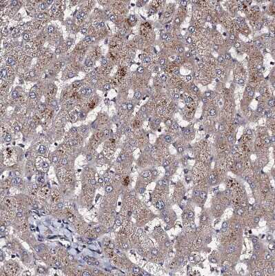 Immunohistochemistry-Paraffin: PPTC7 Antibody [NBP1-90654] - Staining of human liver shows moderate granular cytoplasmic positivity in hepatocytes.