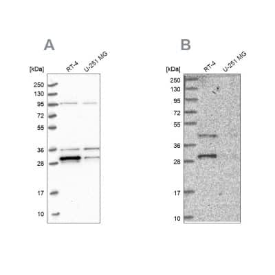 Western Blot: PPTC7 Antibody [NBP1-90654] - Analysis using Anti-PPTC7 antibody NBP1-90654 (A) shows similar pattern to independent antibody NBP1-90653 (B).