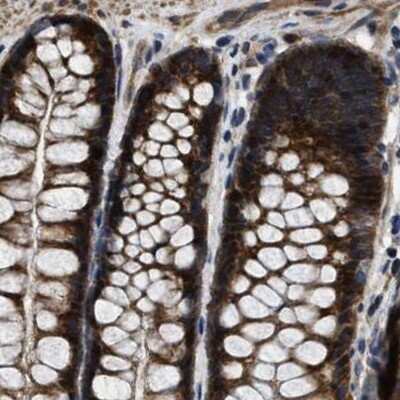 Immunohistochemistry-Paraffin PPWD1 Antibody - BSA Free