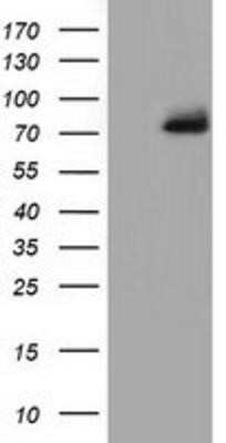 Western Blot: PPWD1 Antibody (OTI1B8) - Azide and BSA Free [NBP2-73590] - HEK293T cells were transfected with the pCMV6-ENTRY control (Left lane) or pCMV6-ENTRY PPWD1 (Right lane) cDNA for 48 hrs and lysed. Equivalent amounts of cell lysates (5 ug per lane) were separated by SDS-PAGE and immunoblotted with anti-PPWD1.