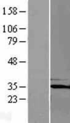 Western Blot: PQBP1 Overexpression Lysate (Adult Normal) [NBP2-08615] Left-Empty vector transfected control cell lysate (HEK293 cell lysate); Right -Over-expression Lysate for PQBP1.