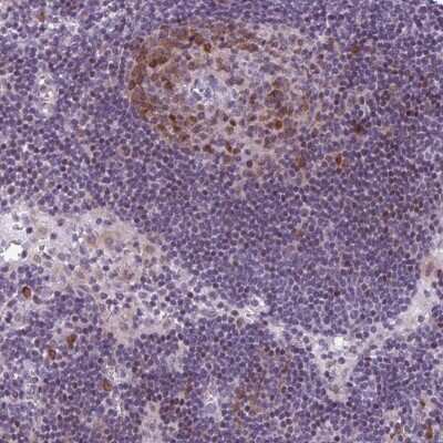 Immunohistochemistry-Paraffin PQLC1 Antibody - BSA Free
