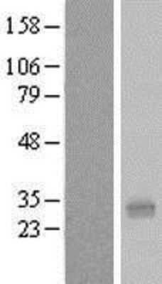 Western Blot PQLC1 Overexpression Lysate
