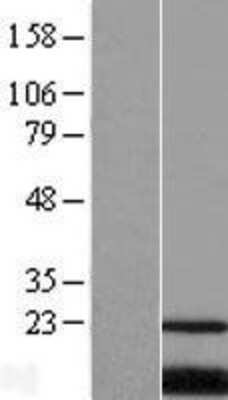Western Blot PQLC2 Overexpression Lysate