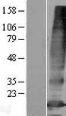 Western Blot: PQLC3 Overexpression Lysate (Adult Normal) [NBP2-05374] Left-Empty vector transfected control cell lysate (HEK293 cell lysate); Right -Over-expression Lysate for PQLC3.
