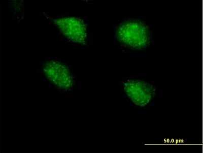 Immunocytochemistry/Immunofluorescence: PR48 Antibody [H00028227-B02P] - Analysis of purified antibody to PPP2R3B on HeLa cell. (antibody concentration 10 ug/ml)