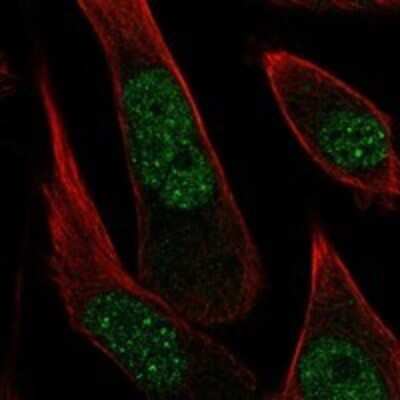Immunocytochemistry/Immunofluorescence: PR48 Antibody [NBP3-17915] - Staining of human cell line PC-3 shows localization to nucleoplasm.