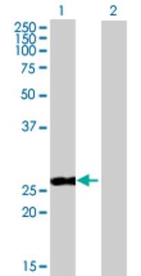 Western Blot: PR48 Antibody [H00028227-B02P] - Analysis of PPP2R3B expression in transfected 293T cell line by PPP2R3B polyclonal antibody.  Lane 1: PPP2R3B transfected lysate(19.36 KDa). Lane 2: Non-transfected lysate.
