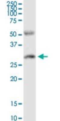 Western Blot: PR48 Antibody [H00028227-D02P] - Analysis of PPP2R3B expression in human placenta.