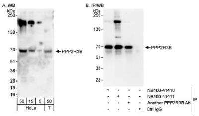 Western Blot: PR48 Antibody [NB100-41411] - Detection of Human PPP2R3B on HeLa whole cell lysate using NB100-41411. PPP2R3B was also immunoprecipitated by another rabbit anti-PPP2R3B antibody and NB100-41410.