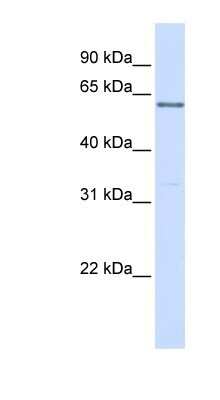 Western Blot: PR48 Antibody [NBP1-58163] - 293T cells lysate, concentration 0.2-1 ug/ml.