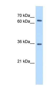 Western Blot: PR48 Antibody [NBP1-58174] - HepG2 cell lysate, concentration 0.2-1 ug/ml.
