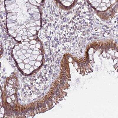 Immunohistochemistry-Paraffin: PRAC Antibody [NBP2-13807] - Staining of human rectum shows strong cytoplasmic positivity in glandular cells.