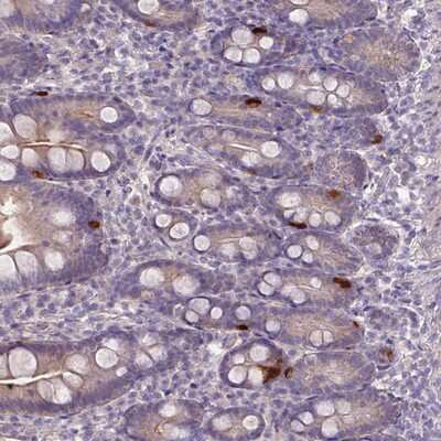 PRADC1/PAP21 Antibody (NBP2-13808): Novus Biologicals