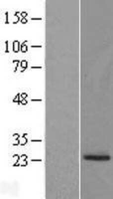 Western Blot: PRADC1/PAP21 Overexpression Lysate (Adult Normal) [NBL1-08430] Left-Empty vector transfected control cell lysate (HEK293 cell lysate); Right -Over-expression Lysate for PRADC1/PAP21.