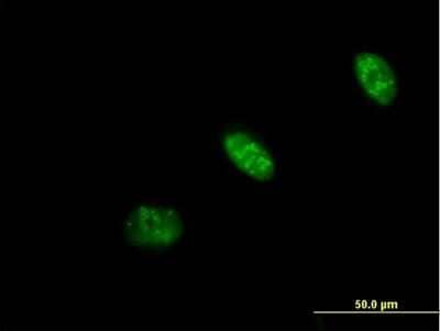 Immunocytochemistry/Immunofluorescence: PRAF1 Antibody [H00064425-B01P] - Analysis of purified antibody to PRAF1 on HeLa cell. (antibody concentration 10 ug/ml)