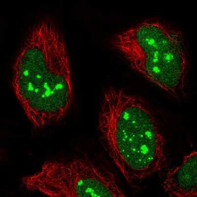 Immunocytochemistry/Immunofluorescence: PRAF1 Antibody [NBP2-56173] - Staining of human cell line HeLa shows localization to nucleus & nucleoli fibrillar center.