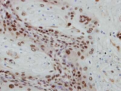 Immunohistochemistry-Paraffin: PRAF1 Antibody [NBP2-19921] - Immunohistochemical analysis of paraffin-embedded Ca922 xenograft, using antibody at 1:500 dilution.