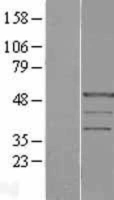 Western Blot: PRAF1 Overexpression Lysate (Adult Normal) [NBL1-14578] Left-Empty vector transfected control cell lysate (HEK293 cell lysate); Right -Over-expression Lysate for PRAF1.